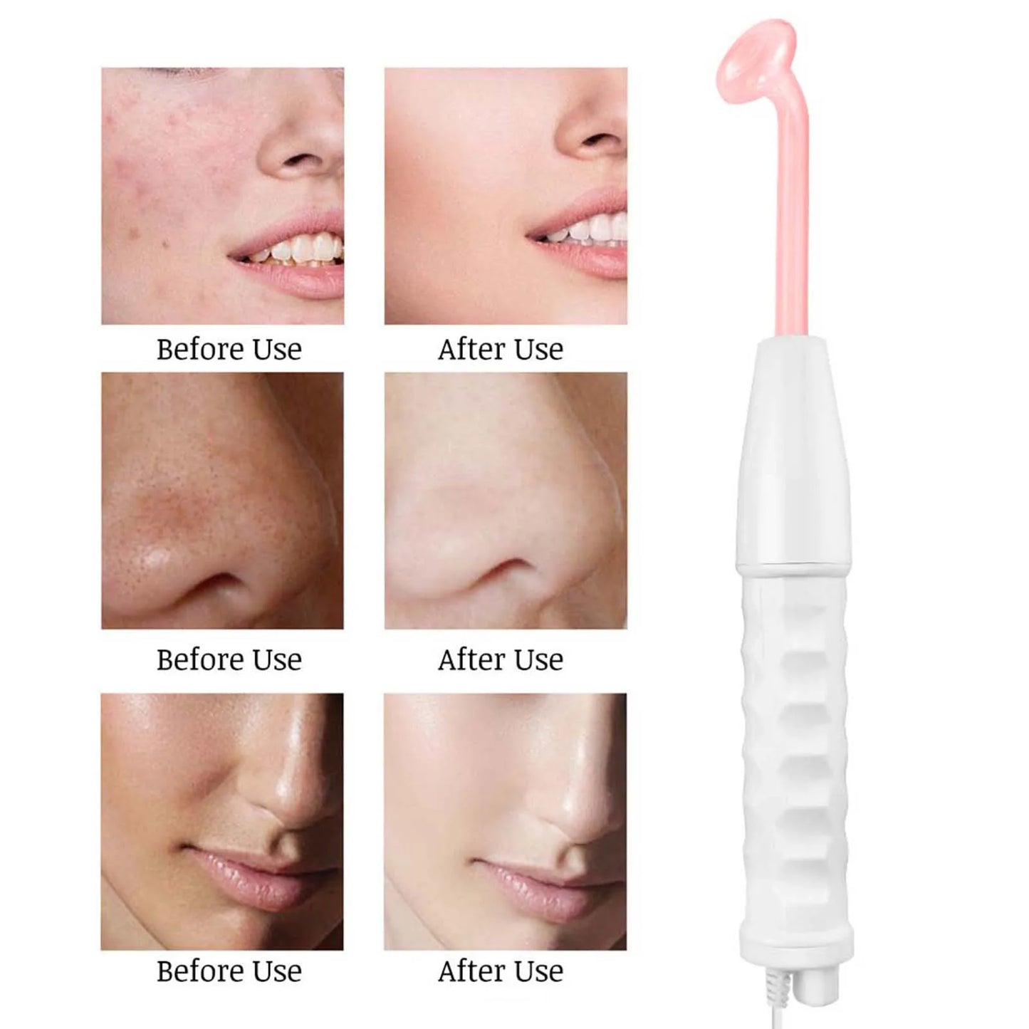 Facial Machine For Skin Tightening Facial Machine High Frequency Electrode Facial Machine For Skin Body Care Wrinkle Remover